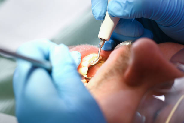 Best Emergency Gum Treatment in Evanston, IL
