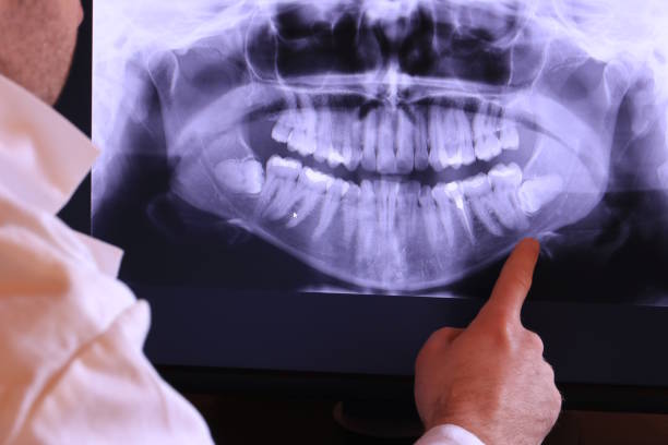 Best Urgent Care for Lost Fillings or Crowns in Evanston, IL