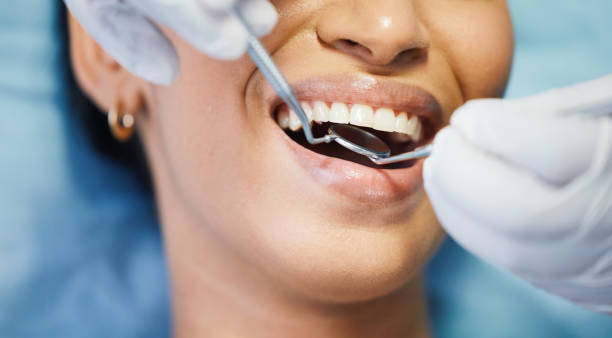 Best Emergency Dental Care for Broken or Chipped Teeth in Evanston, IL