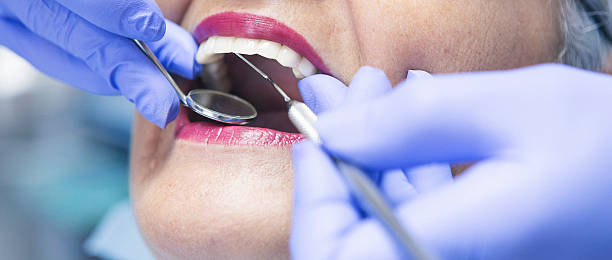 Best Emergency Denture Repair in Evanston, IL